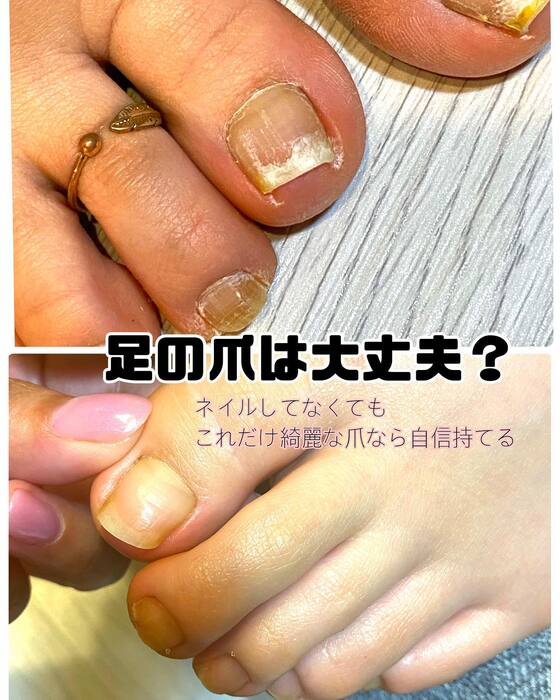 画像715