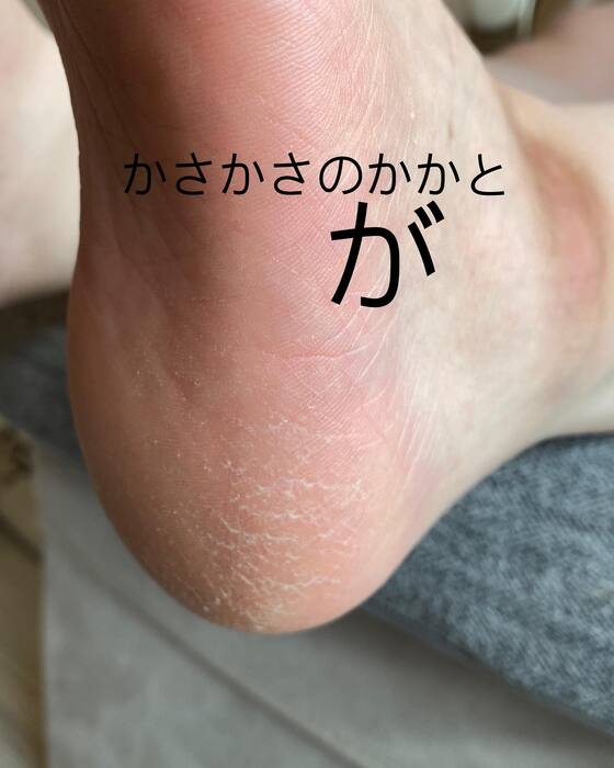 画像916
